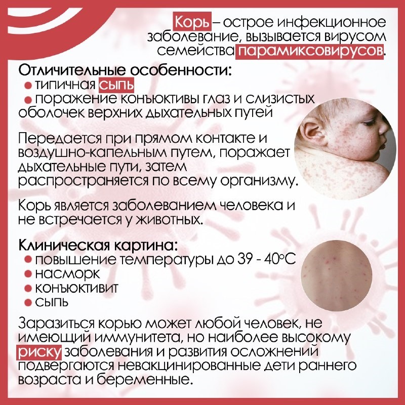 A9R1lxccgz_42hx34_adg.jpg